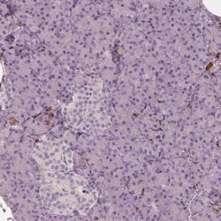 S100A4 Antibody (CL0237), Novus Biologicals 25 &mu;L, Unconjugated:Antibodies,