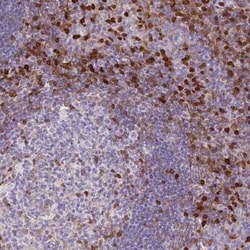 S100A4 Antibody (CL0240), Novus Biologicals 0.1 mL, Unconjugated:Antibodies,