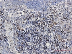 S100A4 Antibody (S01-7H1), Novus Biologicals:Antibodies:Primary Antibodies