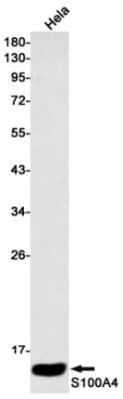 S100A4 Antibody (S01-7H1), Novus Biologicals:Antibodies:Primary Antibodies