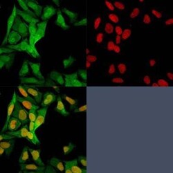 S100A4 Antibody (S100A4/1482), Novus Biologicals:Antibodies:Primary Antibodies