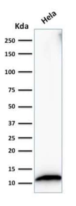 S100A4 Antibody (S100A4/1482), Novus Biologicals:Antibodies:Primary Antibodies