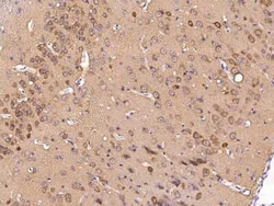 S100A5 Rabbit anti-Mouse, Clone: 1, Novus Biologicals:Antibodies:Primary
