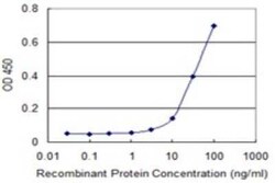 S100A5 Antibody (5E1), Novus Biologicals 0.1 mg | Buy Online | Novus Biologicals | Fisher Scientific