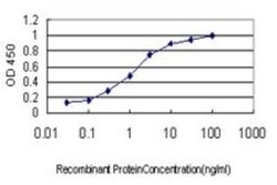 S100A6 Antibody (6B5), Novus Biologicals 0.1 mg | Buy Online | Novus Biologicals | Fisher Scientific