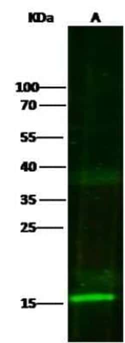 S100A7/Psoriasin Antibody, Novus Biologicals 50 &mu;g; Unconjugated:Anticorps,