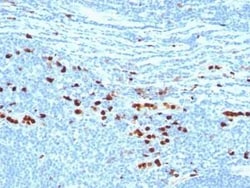 S100A9 Antibody (MAC387), Novus Biologicals:Antibodies:Primary Antibodies