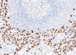 S100A8 Rabbit anti-Human, Clone: 101, Novus Biologicals:Antibodies:Primary