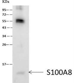 S100A8 Rabbit anti-Human, Clone: 203, Novus Biologicals 50 &mu;g; Unconjugated:Antibodies,