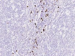 S100A8 Rabbit anti-Human, Clone: 216, Novus Biologicals 50 &mu;g; Unconjugated:Antibodies,