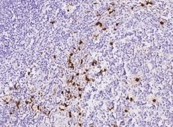 S100A8 Rabbit anti-Human, Clone: 236, Novus Biologicals 100 &mu;g; Unconjugated:Antibodies,