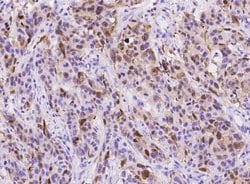 S100A8 Rabbit anti-Human, Clone: 236, Novus Biologicals 100 &mu;g; Unconjugated:Antibodies,