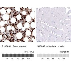 S100A8 Antibody (CL11171), Novus Biologicals 100 &mu;g; Unconjugated:Antibodies,