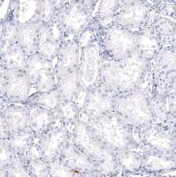 S100A9 Antibody (CL11191), Novus Biologicals 25 &mu;g; Unconjugated:Antibodies,