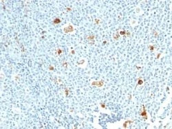 S100A9 Antibody (CPT/1028), Novus Biologicals:Antibodies:Primary Antibodies