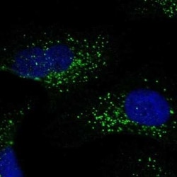 S100B Antibody, Novus Biologicals 25 &mu;L; Unconjugated:Anticuerpos