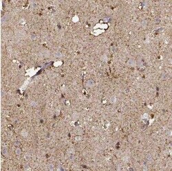 S100B Antibody, Novus Biologicals 25 &mu;L; Unconjugated:Anticuerpos