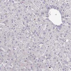 S100B Antibody, Novus Biologicals 25 &mu;L; Unconjugated:Anticuerpos