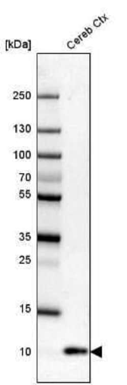 S100B Antibody, Novus Biologicals 25 &mu;L; Unconjugated:Anticuerpos