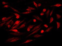S100P Rabbit anti-Human, Clone: 116, Novus Biologicals:Antibodies:Primary