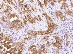 S100P Antibody, Novus Biologicals 50 &mu;g; Unconjugated:Antibodies, Polyclonal