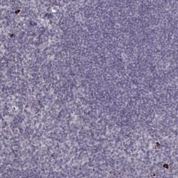 S100Z Antibody, Novus Biologicals:Antibodies:Primary Antibodies