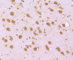S1P1/EDG-1 Antibody (JM10-66), Novus Biologicals 100 &mu;L | Buy Online | Novus Biologicals | Fisher Scientific
