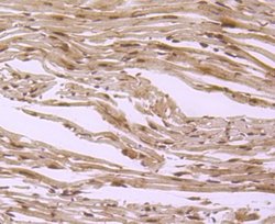S1P1/EDG-1 Antibody (JM10-66), Novus Biologicals 100 &mu;L | Buy Online | Novus Biologicals | Fisher Scientific