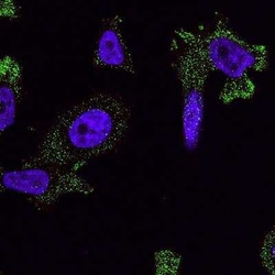 S1P2/EDG-5/S1PR2 Antibody, Novus Biologicals 0.025 mg; Unconjugated:Antibodies,