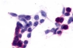S1P2/EDG-5/S1PR2 Antibody, Novus Biologicals 50 &mu;g; Unconjugated:Antibodies,