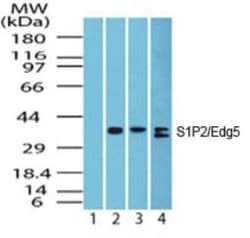 S1P2/EDG-5/S1PR2 Antibody, Novus Biologicals 0.025 mg; Unconjugated:Antibodies,