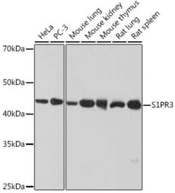 S1P3/EDG-3 Rabbit anti-Human, Mouse, Rat, Clone: 5E3G9, Novus Biologicals:Antibodies:Primary