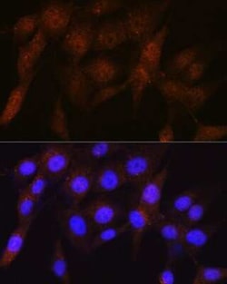S5a/Angiocidin Rabbit anti-Human, Mouse, Rat, Clone: 5G1X6, Novus Biologicals 100 &mu;g | Buy Online | Novus Biologicals | Fisher Scientific