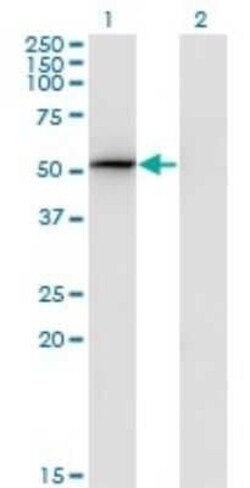 S5a/Angiocidin Antibody (3C9), Novus Biologicals 0.1 mg | Buy Online | Novus Biologicals | Fisher Scientific