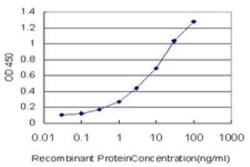 SAFB Antibody (5A11), Novus Biologicals 0.1 mg | Buy Online | Novus Biologicals | Fisher Scientific