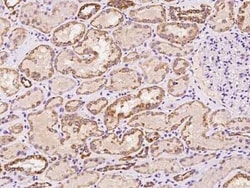SAH3 Antibody, Novus Biologicals 50 &mu;g, Unconjugated:Antibodies, Polyclonal