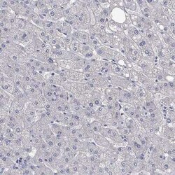 SALM3/LRFN4 Rabbit anti-Human, Polyclonal, Novus Biologicals 100 &mu;g | Buy Online | Novus Biologicals | Fisher Scientific