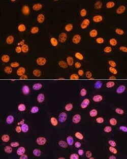 SAM68 Rabbit anti-Human, Mouse, Rat, Clone: 1O7D1, Novus Biologicals 20