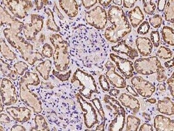 SAMM50 Antibody, Novus Biologicals 50 &mu;g; Unconjugated:Antibodies, Polyclonal