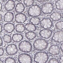 SAP102 Antibody, Novus Biologicals 0.1 mL; Unconjugated:Antibodies, Polyclonal