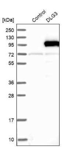 SAP102 Antibody, Novus Biologicals 0.1 mL; Unconjugated:Antibodies, Polyclonal