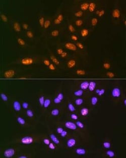 SAP130 Rabbit anti-Human, Mouse, Rat, Clone: 3K1X4, Novus Biologicals 20