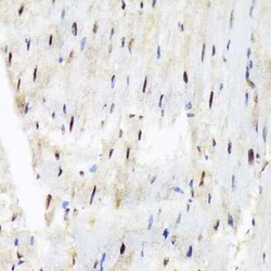 SAP130 Rabbit anti-Human, Mouse, Rat, Clone: 3K1X4, Novus Biologicals 20