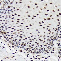 SAP130 Rabbit anti-Human, Mouse, Rat, Clone: 3K1X4, Novus Biologicals 20