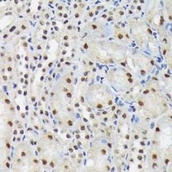 SAP130 Rabbit anti-Human, Mouse, Rat, Clone: 3K1X4, Novus Biologicals 20