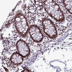 SAP130 Antibody, Novus Biologicals 25ul; Unconjugated:Antibodies, Polyclonal