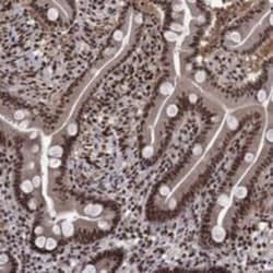 SAP30L Rabbit anti-Human, Polyclonal, Novus Biologicals 100 &mu;g; Unconjugated:Antibodies,