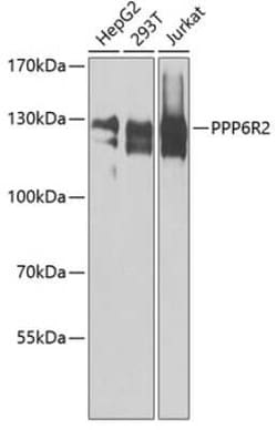 SAPS2 Antibody - BSA Free, Novus Biologicals 0.1 mL; Unconjugated:Anticorps,