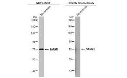 SARM1 Antibody (HL1066), Novus Biologicals 100 &mu;g | Buy Online | Novus Biologicals | Fisher Scientific