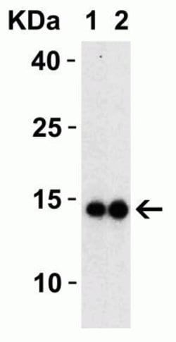 SARS-CoV-2 Membrane Protein Antibody - BSA Free, Novus Biologicals 0.1